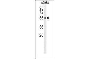 Lane 1: A2058 Cell lysates, probed with MMP14 (133CT15. (MMP14 antibody)