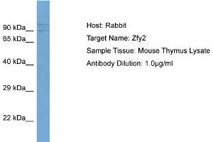 ZFY2 antibody  (Middle Region)