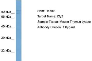 Host:  Rabbit  Target Name:  Zfy2  Sample Type:  Mouse Thymus lysates  Antibody Dilution:  1. (ZFY2 antibody  (Middle Region))