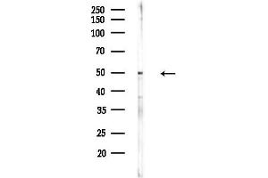 anti-Forkhead Box L2 (FOXL2) (pSer263) antibody