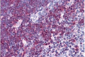 ABIN185573 (3. (Stathmin 1 antibody  (C-Term))
