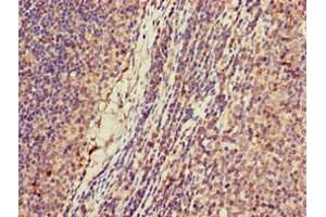 Immunohistochemistry of paraffin-embedded human lymph node tissue using ABIN7157644 at dilution of 1:100 (KIF2A antibody  (AA 5-308))
