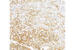 Immunohistochemistry (IHC) image for anti-CD44 (CD44) (AA 700-742) antibody (ABIN7454002) (Recombinant CD44 antibody  (AA 700-742))