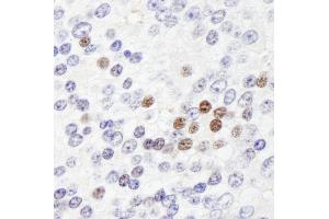 Immunohistochemistry (IHC) image for anti-Zinc Fingers and Homeoboxes 3 (ZHX3) (AA 150-200) antibody (ABIN7449040) (ZHX3 antibody  (AA 150-200))