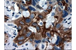Image no. 2 for anti-Keratin 18 (KRT18) (AA 69-372) antibody (ABIN1491637) (Cytokeratin 18 antibody  (AA 69-372))