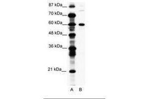 Image no. 1 for anti-CCR4-NOT Transcription Complex, Subunit 3 (CNOT3) (AA 141-190) antibody (ABIN203225)
