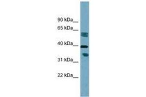 Image no. 1 for anti-Dehydrogenase/reductase (SDR Family) Member 7B (DHRS7B) (AA 215-264) antibody (ABIN6742028) (DHRS7B antibody  (AA 215-264))