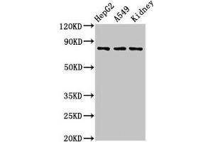 Western Blot Positive WB detected in: HepG2 whole cell lysate, A549 whole cell lysate, Rat kidney tissue All lanes: UIMC1 antibody at 3 μg/mL Secondary Goat polyclonal to rabbit IgG at 1/50000 dilution Predicted band size: 80, 62, 71, 39, 18 kDa Observed band size: 80 kDa (UIMC1 antibody  (AA 161-235))