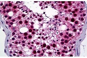 Human Testis: Formalin-Fixed, Paraffin-Embedded (FFPE) (NEK2 antibody  (AA 331-445))