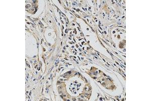 Immunohistochemistry (IHC) image for anti-Eukaryotic Translation Initiation Factor 4E (EIF4E) (AA 1-100) antibody (ABIN3023085)