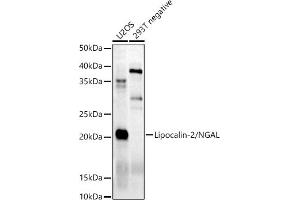 Western blot analysis of extracts of various cell lines, using Lipocalin-2/NGAL antibody (ABIN6128177, ABIN6143114, ABIN6143115 and ABIN6215076) at 1:500 dilution. (Lipocalin 2 antibody)