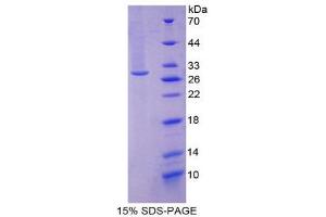 SDS-PAGE (SDS) image for gamma Glutamyltransferase 1 (GGT1) (AA 296-537) protein (His tag) (ABIN2124919) (GGT1 Protein (AA 296-537) (His tag))