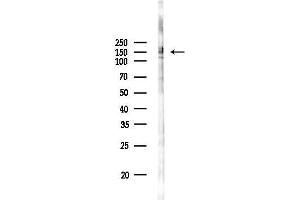 anti-Sperm Associated Antigen 9 (SPAG9) (C-Term) antibody