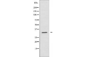 Western blot analysis of extracts from HUVEC cells using ABHD11 antibody.