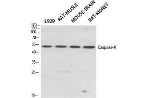 Western Blotting (WB) image for anti-Caspase 9, Apoptosis-Related Cysteine Peptidase (CASP9) (Thr125) antibody (ABIN5960804) (Caspase 9 antibody  (Thr125))