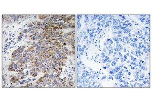 Immunohistochemistry (IHC) image for anti-Carbohydrate Sulfotransferase 10 (CHST10) (Internal Region) antibody (ABIN1850990) (CHST10 antibody  (Internal Region))