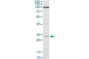 ATG5 monoclonal antibody (M05), clone 1E7. (ATG5 antibody  (AA 176-275))