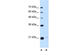 Western Blotting (WB) image for anti-Transmembrane Emp24 Protein Transport Domain Containing 3 (TMED3) antibody (ABIN2463022) (TMED3 antibody)