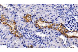 Immunohistochemistry (IHC) image for anti-Keratin 5 (KRT5) (AA 335-473) antibody (ABIN7437212)