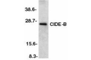 Western blot analysis of CIDE-B in mouse liver tissue lysate with AP30231PU-N CIDE-B antibody at 1/500 dilution. (CIDEB antibody  (C-Term))