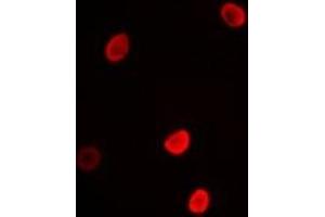 Immunofluorescent analysis of L3MBTL3 staining in MCF7 cells. (L3MBTL3 antibody)