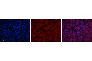 Rabbit Anti-GGCX Antibody      Formalin Fixed Paraffin Embedded Tissue: Human Adult Liver   Observed Staining: Cytoplasm in hepatocytes, strong signal, wide tissue distribution  Primary Antibody Concentration: 1:100  Secondary Antibody: Donkey anti-Rabbit-Cy3  Secondary Antibody Concentration: 1:200  Magnification: 20X  Exposure Time: 0. (GGCX antibody  (Middle Region))