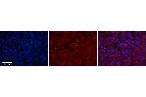 Rabbit Anti-GGCX Antibody      Formalin Fixed Paraffin Embedded Tissue: Human Adult Liver   Observed Staining: Cytoplasm in hepatocytes, strong signal, wide tissue distribution  Primary Antibody Concentration: 1:100  Secondary Antibody: Donkey anti-Rabbit-Cy3  Secondary Antibody Concentration: 1:200  Magnification: 20X  Exposure Time: 0.