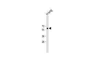 Anti-SD6 Antibody (Center) at 1:500 dilution + H.