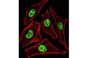Immunofluorescence (IF) image for anti-SWI/SNF Related, Matrix Associated, Actin Dependent Regulator of Chromatin, Subfamily D, Member 3 (SMARCD3) (AA 27-60), (N-Term) antibody (ABIN6242643)