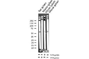 Western blot analysis of Phospho-Lck (Tyr393) expression in various lysates (LCK antibody  (pTyr393))