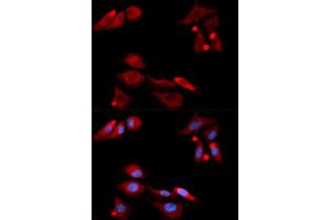 Immunofluorescence analysis of U2OS cells using GFRA1 antibody (ABIN5973109).