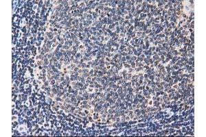 Image no. 8 for anti-Striatin Interacting Protein 1 (STRIP1) antibody (ABIN1498205) (STRIP1 antibody)