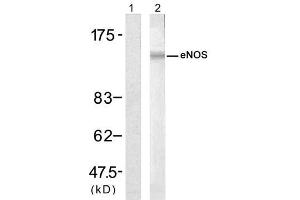 Western blot analysis of extract from H (ENOS antibody)