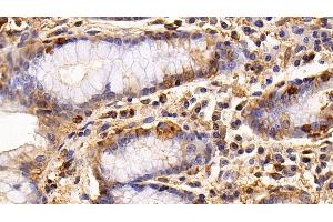 Immunohistochemistry (IHC) image for anti-Epidermal Growth Factor Receptor (EGFR) (AA 888-1210) antibody (ABIN7426025)