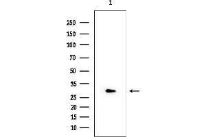 Western blot analysis of lysates from EC304 cells, using 14-3-3 gamma Mouse Monoclonal Antibody at 1/1000 dilution.