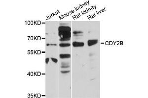 Western blot analysis of extracts of various cell lines, using CDY2B antibody (ABIN6292882) at 1:3000 dilution. (CDY2A antibody)
