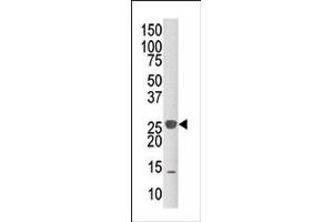 Image no. 1 for anti-Dual Specificity Phosphatase 14 (DUSP14) (C-Term) antibody (ABIN360795) (DUSP14 antibody  (C-Term))