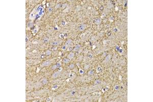 Immunohistochemistry of paraffin-embedded mouse brain using KCND3 antibody (ABIN5975445) at dilution of 1/100 (40x lens). (KCND3 antibody)