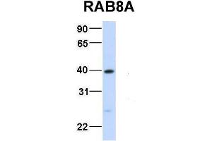 Host:  Rabbit  Target Name:  RAB8A  Sample Type:  Human Fetal Liver  Antibody Dilution:  1. (RAB8A antibody  (Middle Region))