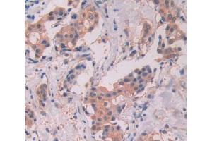 Used in DAB staining on fromalin fixed paraffin- embedded Kidney tissue (STAT5A antibody  (AA 586-688))
