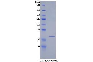 SDS-PAGE analysis of Rat SFRP5 Protein.