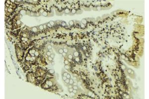 ABIN6269061 at 1/100 staining Mouse colon tissue by IHC-P. (JAK2 antibody  (N-Term))