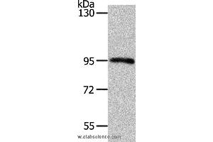Western blot analysis of Mouse kidney tissue, using MYSM1 Polyclonal Antibody at dilution of 1:1100 (MYSM1 antibody)