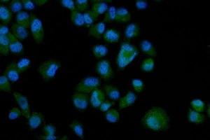 IF analysis of Eph Receptor A3/EPHA3 using anti-Eph Receptor A3/EPHA3 antibody (ABIN7602102).