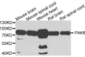 Western blot analysis of extracts of various cell lines, using PAK6 antibody. (PAK6 antibody)
