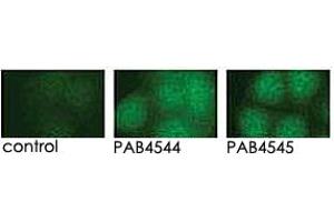 Indirect immunofluorescence analysis of GFP-PRKD3 fusion protein expression in Panc-1 cells by using PRKD3 polyclonal antibody  and PRKD3 polyclonal antibody  . (PRKD3 antibody  (Internal Region))