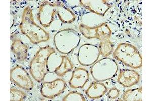 Immunohistochemistry of paraffin-embedded human kidney tissue using ABIN7146236 at dilution of 1:100 (CDH6 antibody  (AA 1-250))