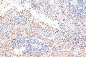 Immunohistochemistry of paraffin-embedded rat spleen using CD274 Antibody (ABIN5997392) at dilution of 1/100 (40x lens).
