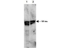 Western blot using ECT2 (phospho T790) polyclonal antibody  showsdetection of endogenous phospho-ECT2 (arrowhead) present in cell lysates from interphase (Lane 1) and mitotic (Lane 2) HeLa cells. (ECT2 antibody  (pThr790))