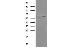 HEK293T cells were transfected with the pCMV6-ENTRY control (Left lane) or pCMV6-ENTRY PPAT (Right lane) cDNA for 48 hrs and lysed. (PPAT antibody  (AA 42-278))